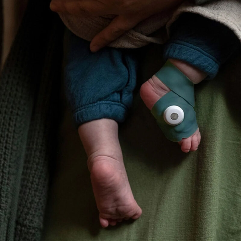 Owlet Smart Sock BMRHNN67IM Bebek Monitörü Derin Deniz Yeşili
